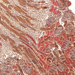 sars-cov-2 gene expression in a human fetus